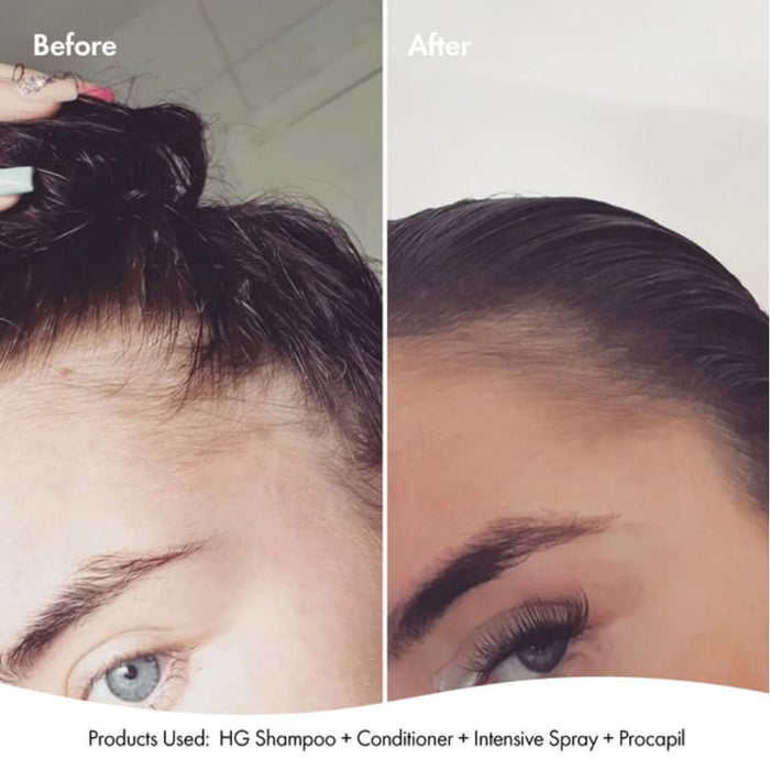 Bondi Boost Anti-Thinning Procapil® Scalp Tonic